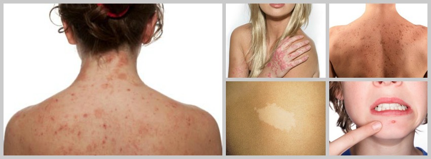 Dermatovenerologai